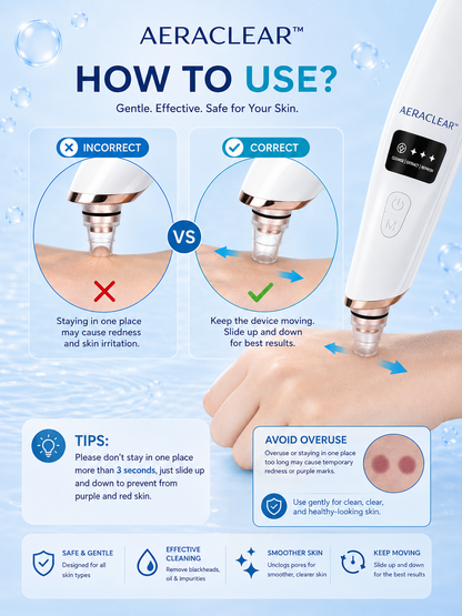 AeraClear Electric Blackhead Remover Vacuum