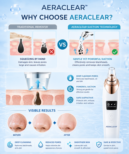 AeraClear Electric Blackhead Remover Vacuum