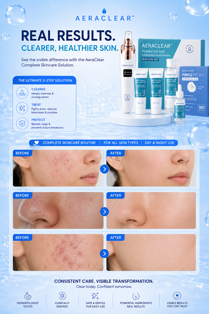 AeraClear Ultimate Acne Solution Kit