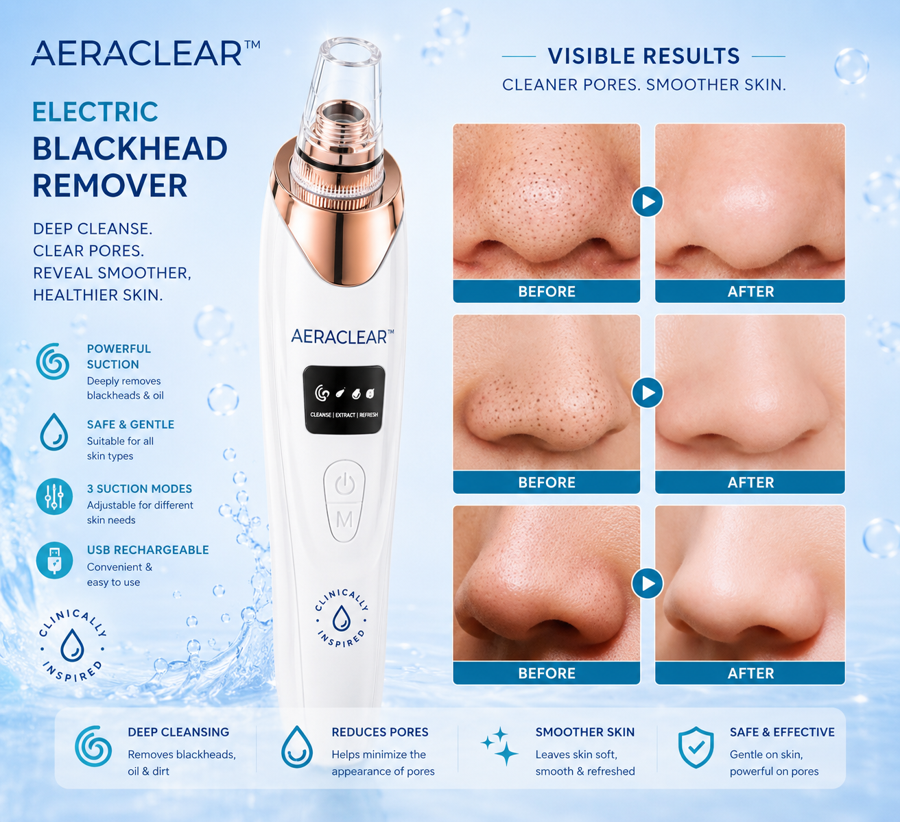 AeraClear Electric Blackhead Remover Vacuum